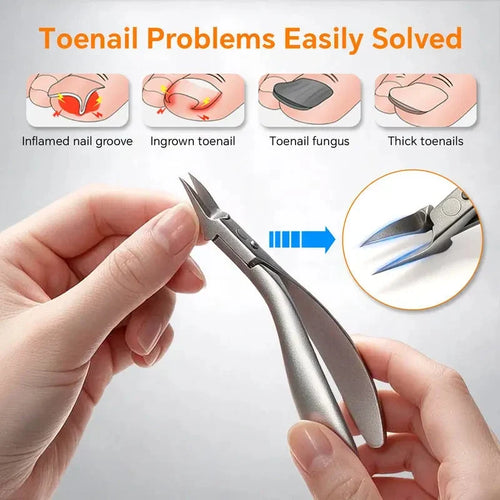 🦶 Limited-time 49% Off! ⚡ Stainless Steel Ingrown Toenail Clipper Set – Precise, Sturdy, Portable ✨